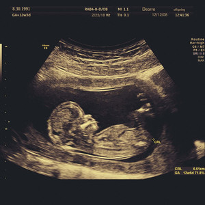 欧美另类SAMXXX残虐
